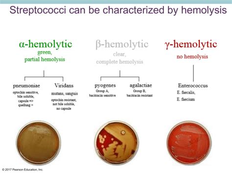 beta hemolytic streptococci|Thalassemia .